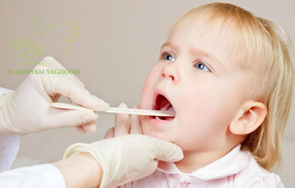 درمان آدونئید یا لوزه سوم