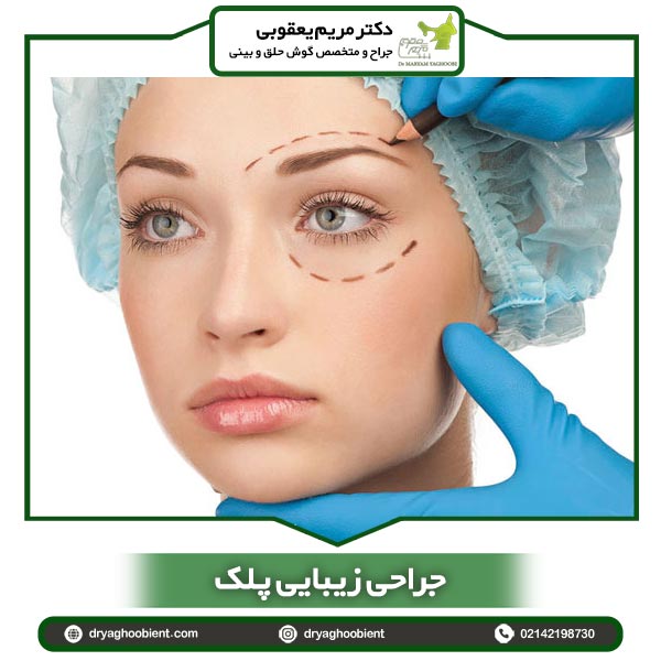 جراحی زیبایی پلک