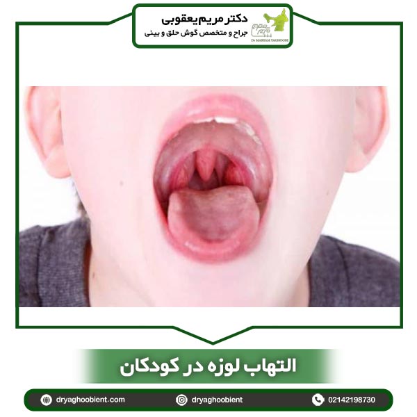 التهاب لوزه در کودکان