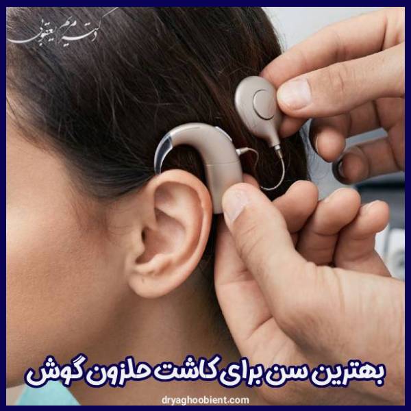 سن مناسب کاشت حلزون گوش - دکتر مریم یعقوبی