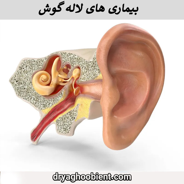 بیماری های لاله گوش