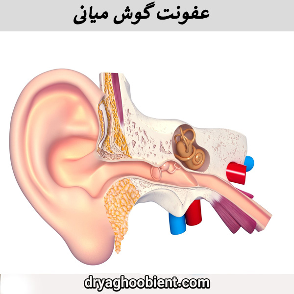 عفونت گوش میانی