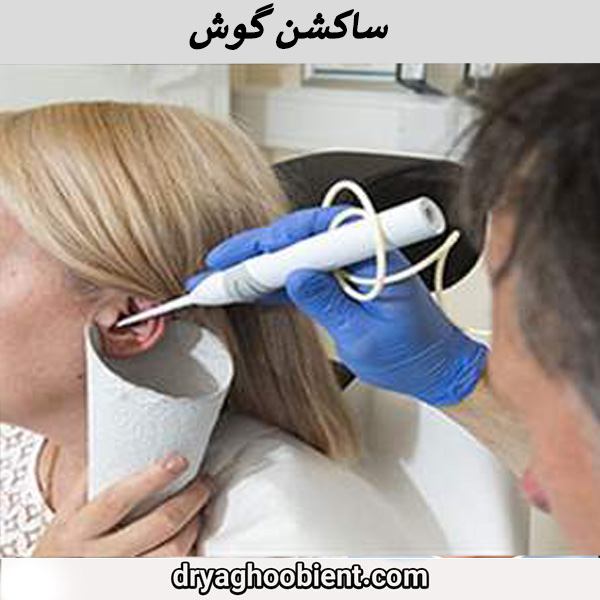 ساکشن گوش
