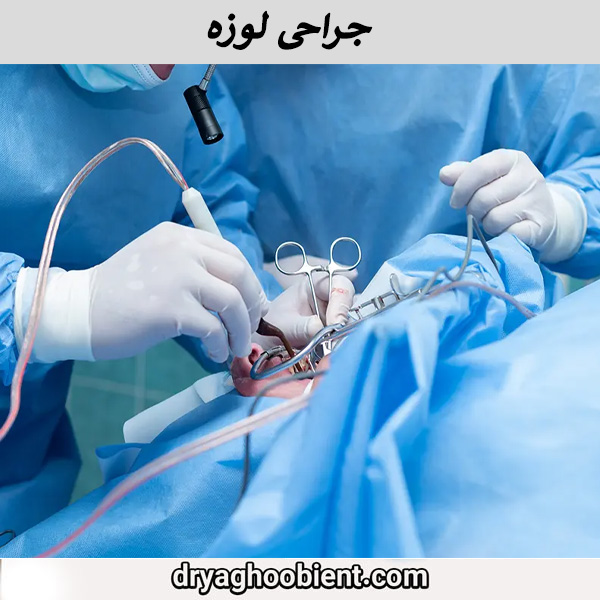 جراحی لوزه