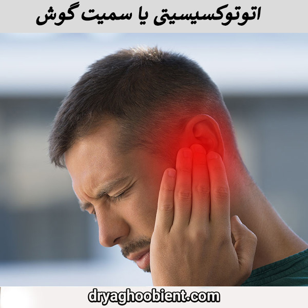 اتوتوکسیسیتی یا سمیت گوش