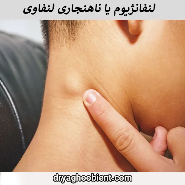 لنفانژیوم یا ناهنجاری لنفاوی چیست ؟ علت ، انواع و درمان- یعقوبی