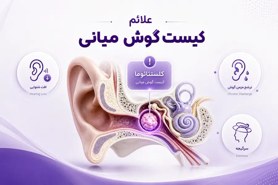 علائم کیست گوش میانی چیست؟ نشانههای کلستئاتوما و زمان مراجعه
